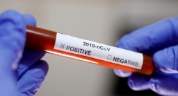 В «ДНР» число заболевших COVID-19 превысило 900 человек, а летальных случаев – 7 в сутки